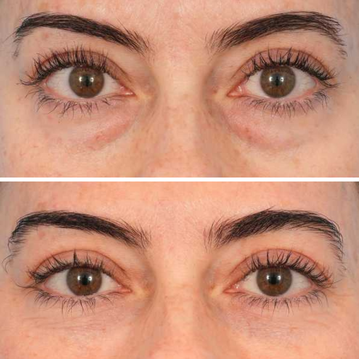 Customer result