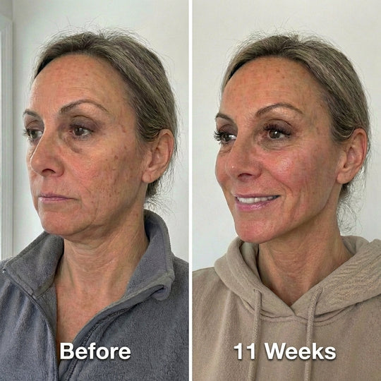 Jawline Collagen Mask