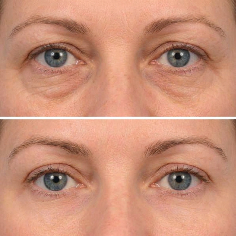 Customer result