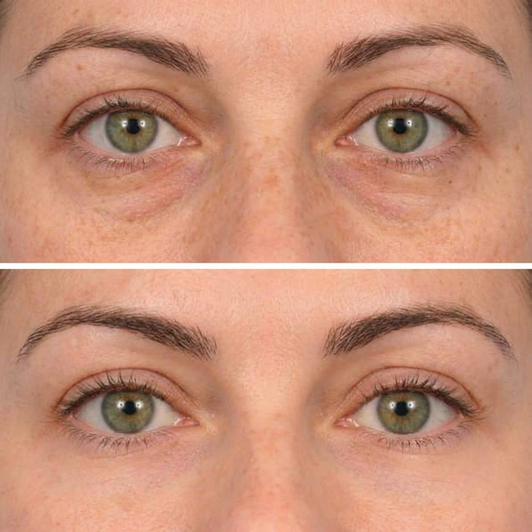 Customer result