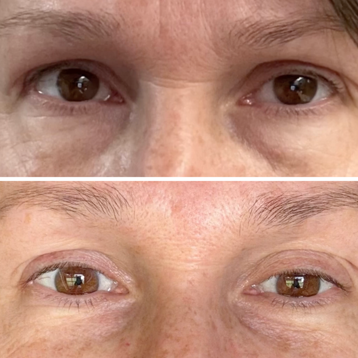 Customer result